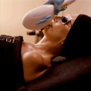 tratamiento-facial
