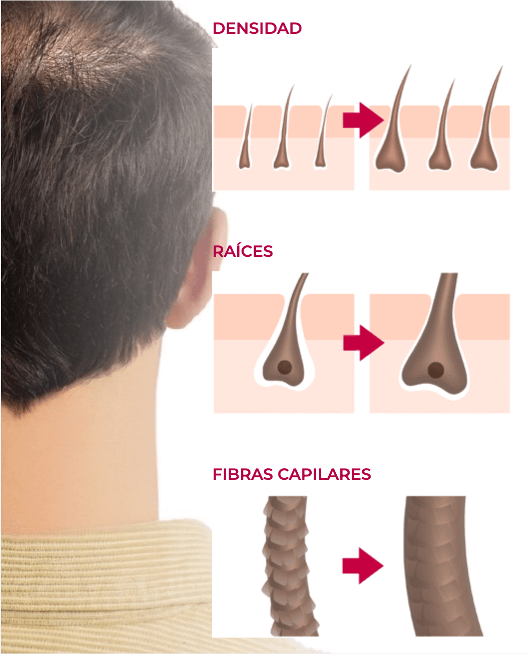 Tratamiento capilar para hombre Hair Summum